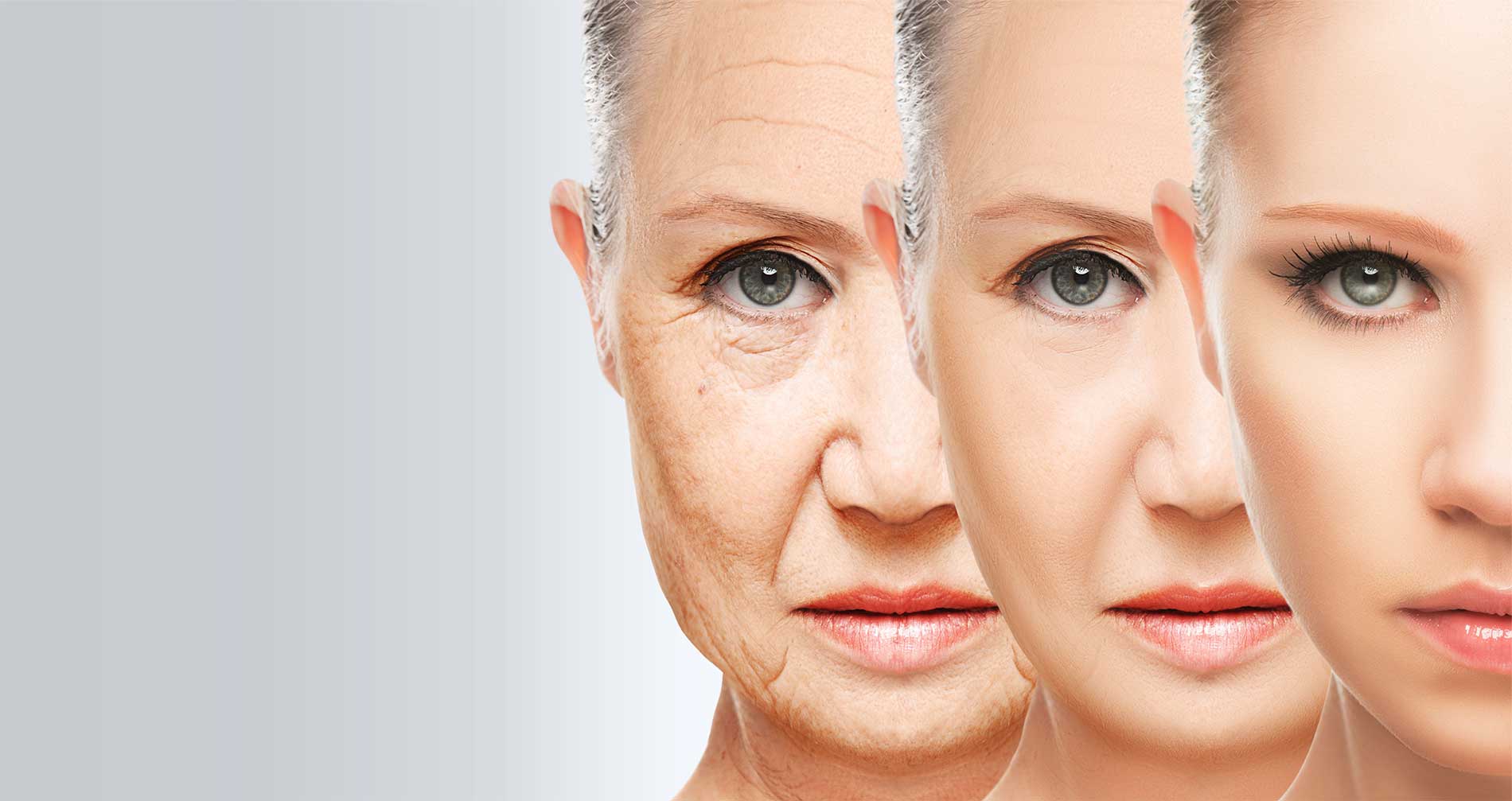 termsofageing